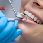 Why Dental Cleanings Are Essential